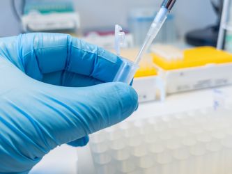 Nitrile Gloves vs. Latex Gloves: Understanding the Differences and Choosing the Best Option